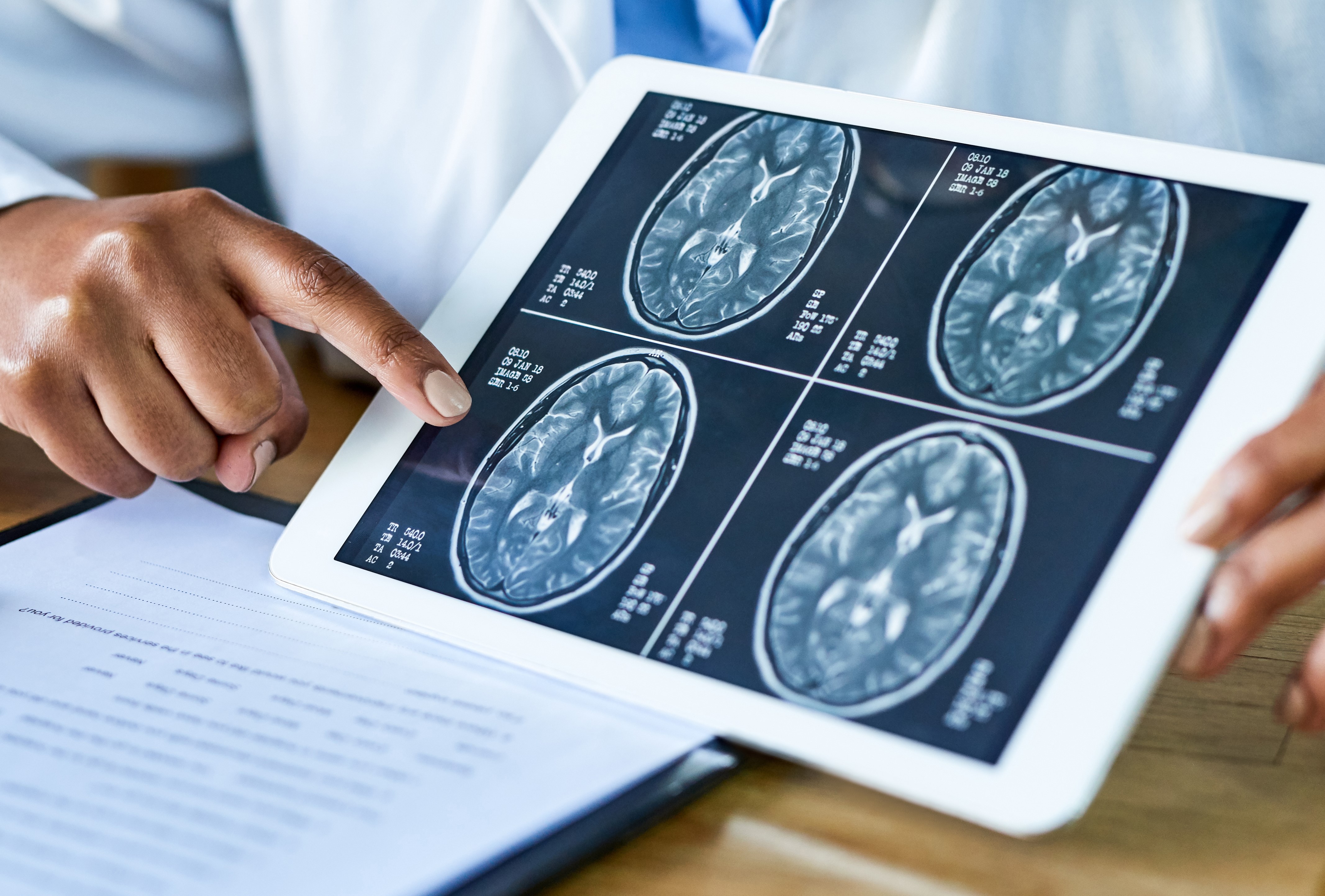 Hands belonging to a white-coated physician point to MRI scans on a tablet